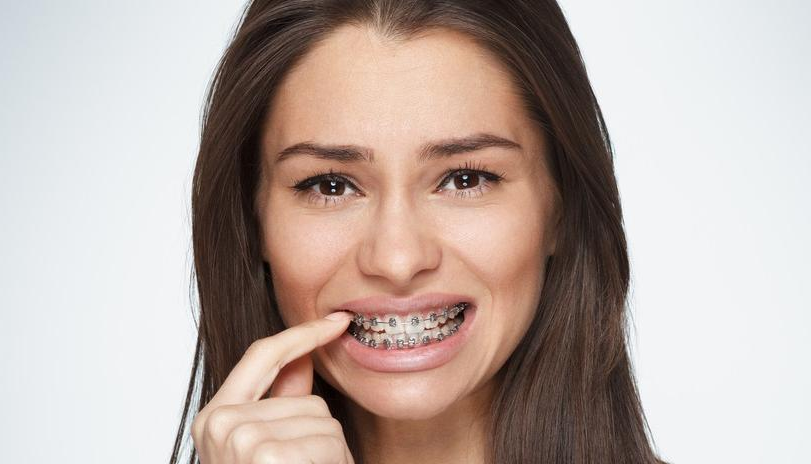 Что делать, если болят зубы после установки брекетов?
