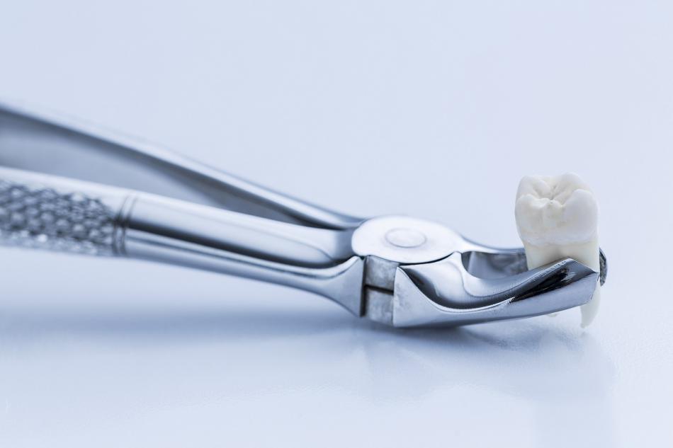 Сколько стоит удалить зуб в клинике?
