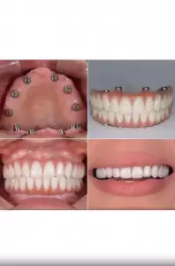 Фотография Новая Улыбка 3