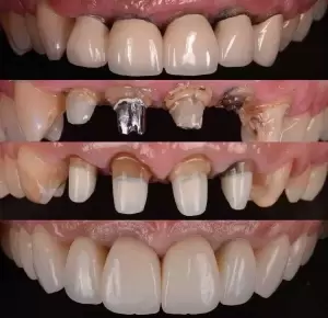 Фотография Новая Улыбка 2