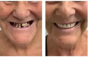 Фотография Новая Улыбка 4