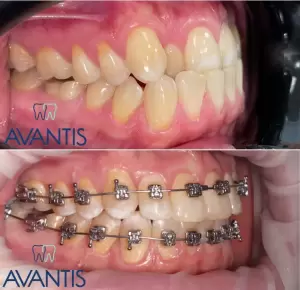 Фотография Авантис 1