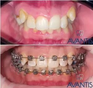 Фотография Авантис 4